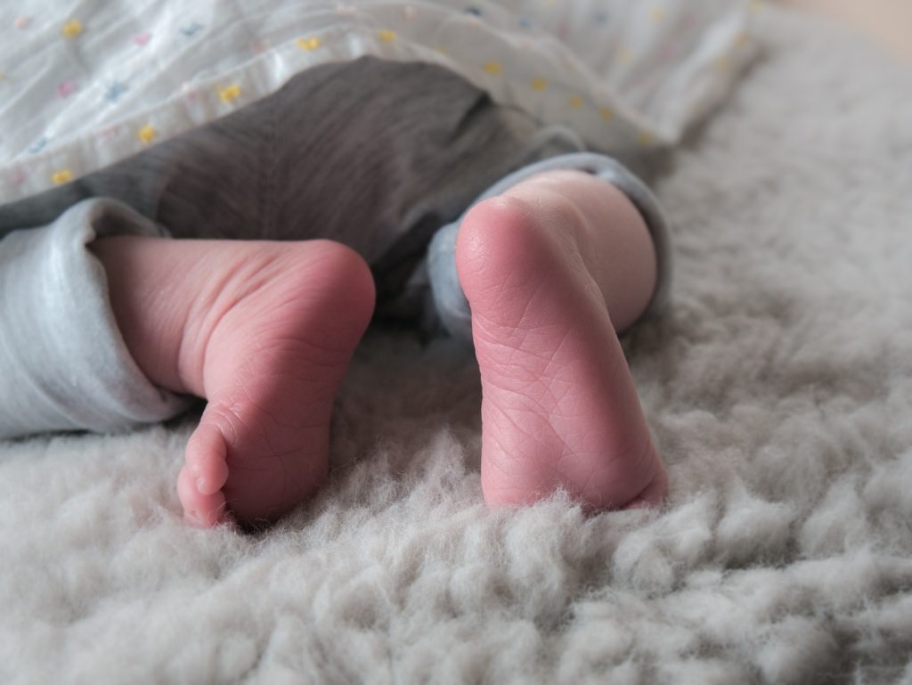 赤ちゃんの頭皮や体にかさぶたがいっぱい 乳児脂漏性湿疹とは メイキーズメディア